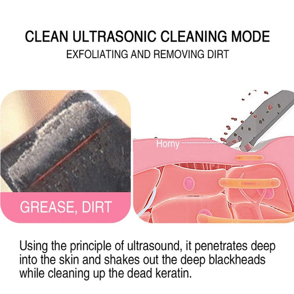 GlowEase™ Skin Scrubber - Your Path to Flawless Skin! - Luceroclub.com